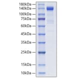SDS-PAGE - Recombinant Human PSMA Protein (N-terminal Human Fc Tag) (A331194) - Antibodies.com
