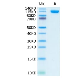 Tris-Bis PAGE - Recombinant Human PSMA Protein (N-terminal Human Fc Tag) (A331195) - Antibodies.com