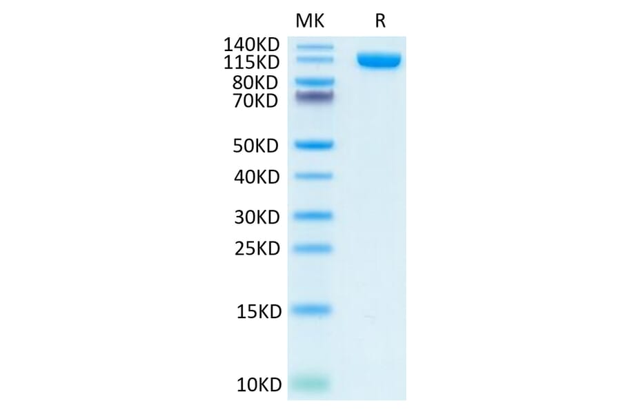 Tris-Bis PAGE - Recombinant Human PSMA Protein (N-terminal Human Fc Tag) (A331195) - Antibodies.com