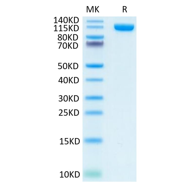 Tris-Bis PAGE - Recombinant Human PSMA Protein (N-terminal Human Fc Tag) (A331195) - Antibodies.com