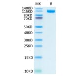 Tris-Bis PAGE - Recombinant Human PSMA Protein (N-terminal Human Fc Tag) (A331195) - Antibodies.com