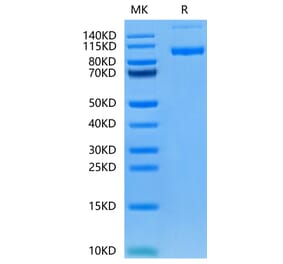 Tris-Bis PAGE - Recombinant Human PSMA Protein (N-terminal His Tag) (A331196) - Antibodies.com