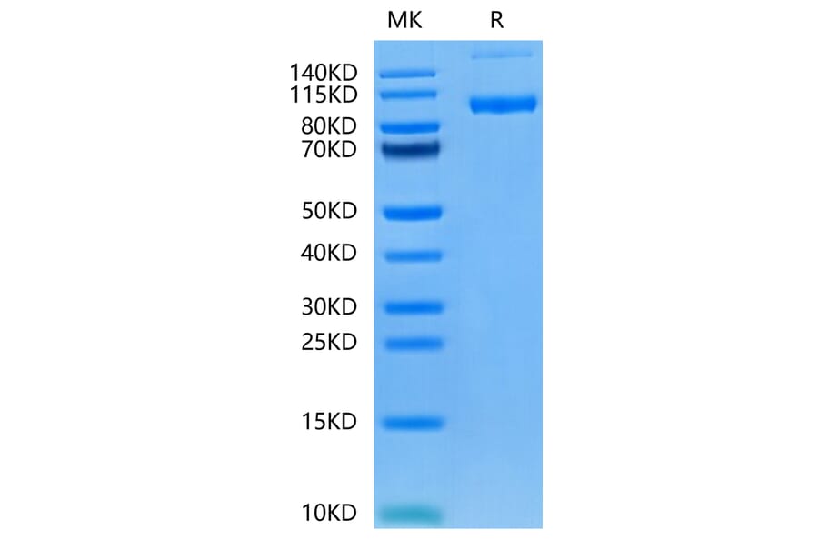 Tris-Bis PAGE - Recombinant Human PSMA Protein (N-terminal His Tag) (A331196) - Antibodies.com