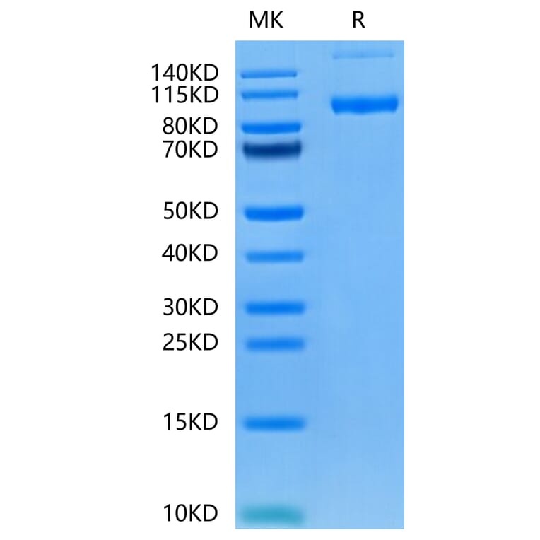 Tris-Bis PAGE - Recombinant Human PSMA Protein (N-terminal His Tag) (A331196) - Antibodies.com