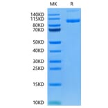 Tris-Bis PAGE - Recombinant Human PSMA Protein (N-terminal His Tag) (A331196) - Antibodies.com