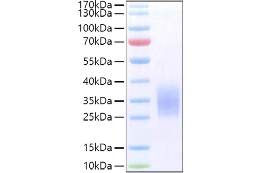 SDS-PAGE - Recombinant Human PTH1R Protein (C-terminal His Tag) (A331197) - Antibodies.com