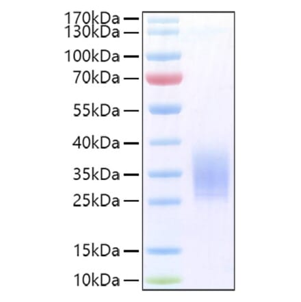 SDS-PAGE - Recombinant Human PTH1R Protein (C-terminal His Tag) (A331197) - Antibodies.com