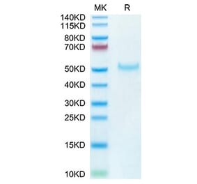Tris-Bis PAGE - Recombinant Cynomolgus macaque PVRIG Protein (C-terminal Human Fc Tag) (A331198) - Antibodies.com