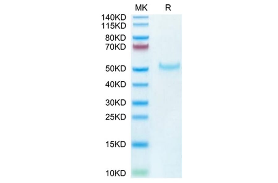Tris-Bis PAGE - Recombinant Cynomolgus macaque PVRIG Protein (C-terminal Human Fc Tag) (A331198) - Antibodies.com