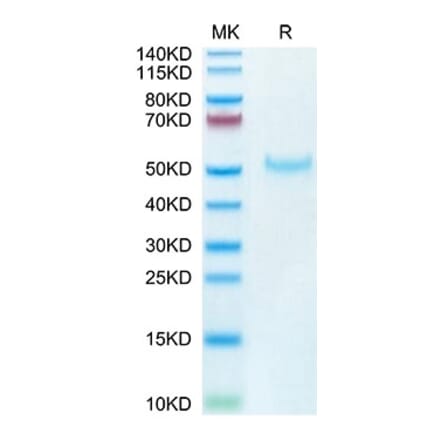 Tris-Bis PAGE - Recombinant Cynomolgus macaque PVRIG Protein (C-terminal Human Fc Tag) (A331198) - Antibodies.com