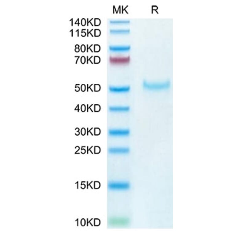 Tris-Bis PAGE - Recombinant Cynomolgus macaque PVRIG Protein (C-terminal Human Fc Tag) (A331198) - Antibodies.com