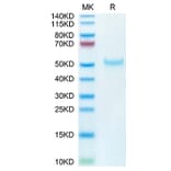 Tris-Bis PAGE - Recombinant Cynomolgus macaque PVRIG Protein (C-terminal Human Fc Tag) (A331198) - Antibodies.com