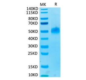 Tris-Bis PAGE - Recombinant Human PVRIG Protein (C-terminal Mouse Fc Tag) (A331199) - Antibodies.com