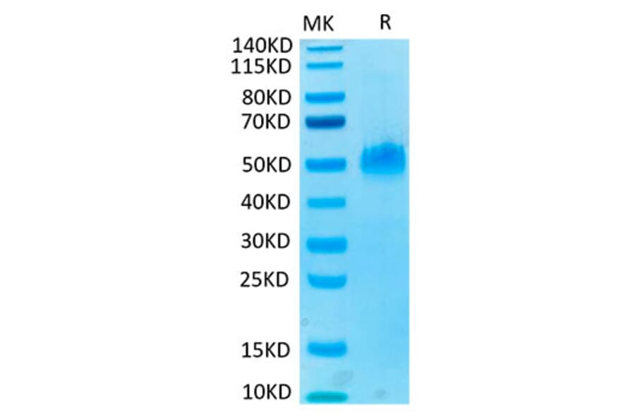 Tris-Bis PAGE - Recombinant Human PVRIG Protein (C-terminal Mouse Fc Tag) (A331199) - Antibodies.com