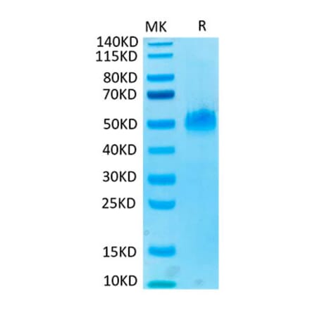 Tris-Bis PAGE - Recombinant Human PVRIG Protein (C-terminal Mouse Fc Tag) (A331199) - Antibodies.com
