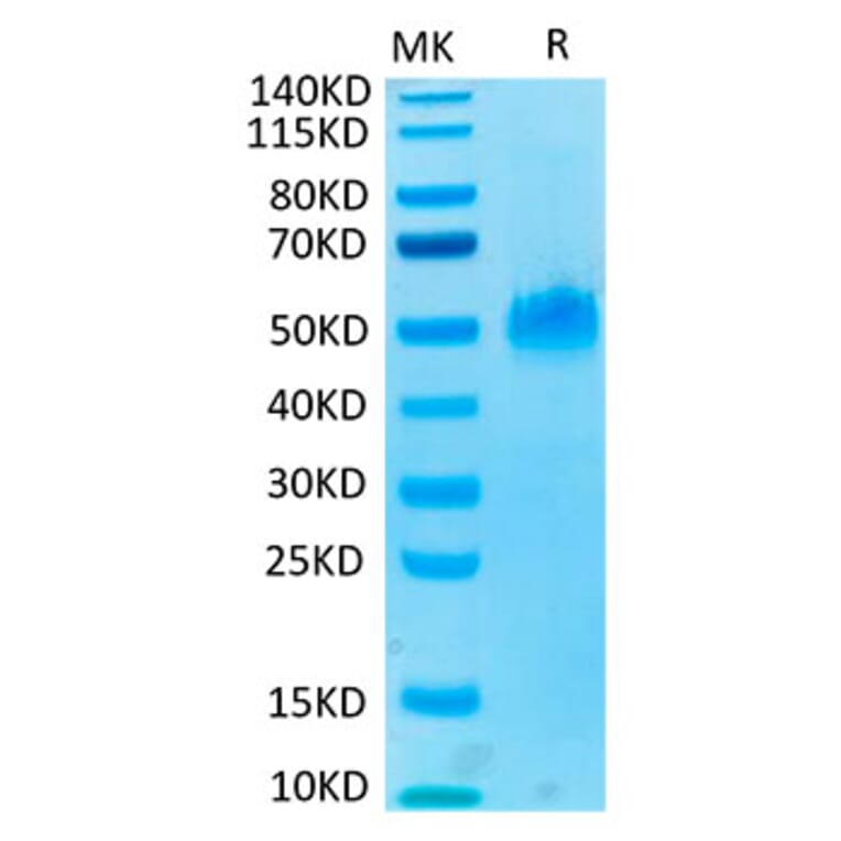 Tris-Bis PAGE - Recombinant Human PVRIG Protein (C-terminal Mouse Fc Tag) (A331199) - Antibodies.com