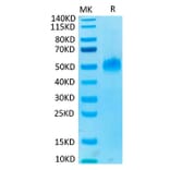 Tris-Bis PAGE - Recombinant Human PVRIG Protein (C-terminal Mouse Fc Tag) (A331199) - Antibodies.com