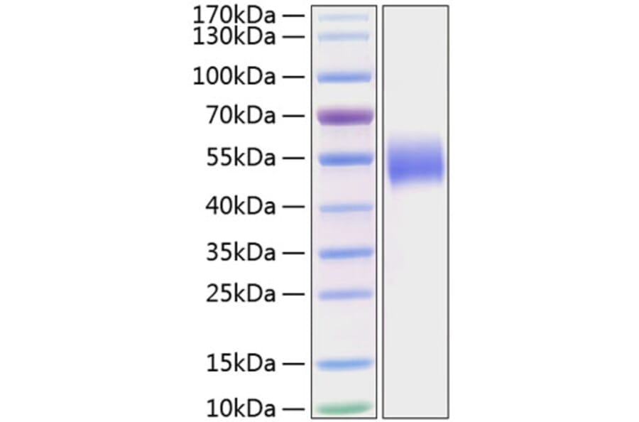 SDS-PAGE - Recombinant Human PVRL1 Protein (C-terminal His Tag) (A331200) - Antibodies.com