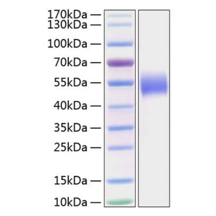 SDS-PAGE - Recombinant Human PVRL1 Protein (C-terminal His Tag) (A331200) - Antibodies.com
