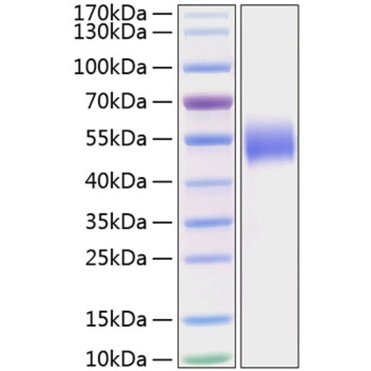 SDS-PAGE - Recombinant Human PVRL1 Protein (C-terminal His Tag) (A331200) - Antibodies.com