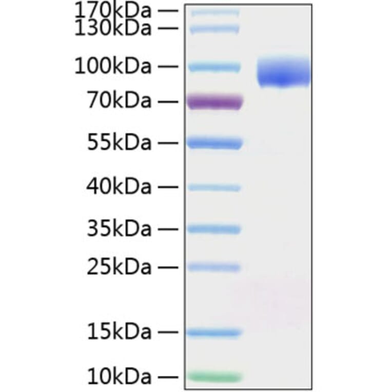SDS-PAGE - Recombinant Human PVRL1 Protein (C-terminal Human Fc and His Tag) (A331201) - Antibodies.com