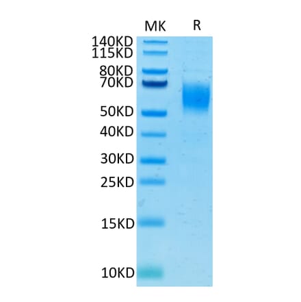Tris-Bis PAGE - Recombinant Human PVRL1 Protein (C-terminal His and Avi Tag) (A331203) - Antibodies.com