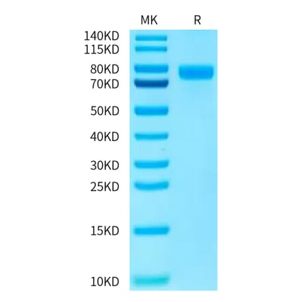 Tris-Bis PAGE - Recombinant Human PVRL1 Protein (C-terminal Human Fc Tag) (A331204) - Antibodies.com