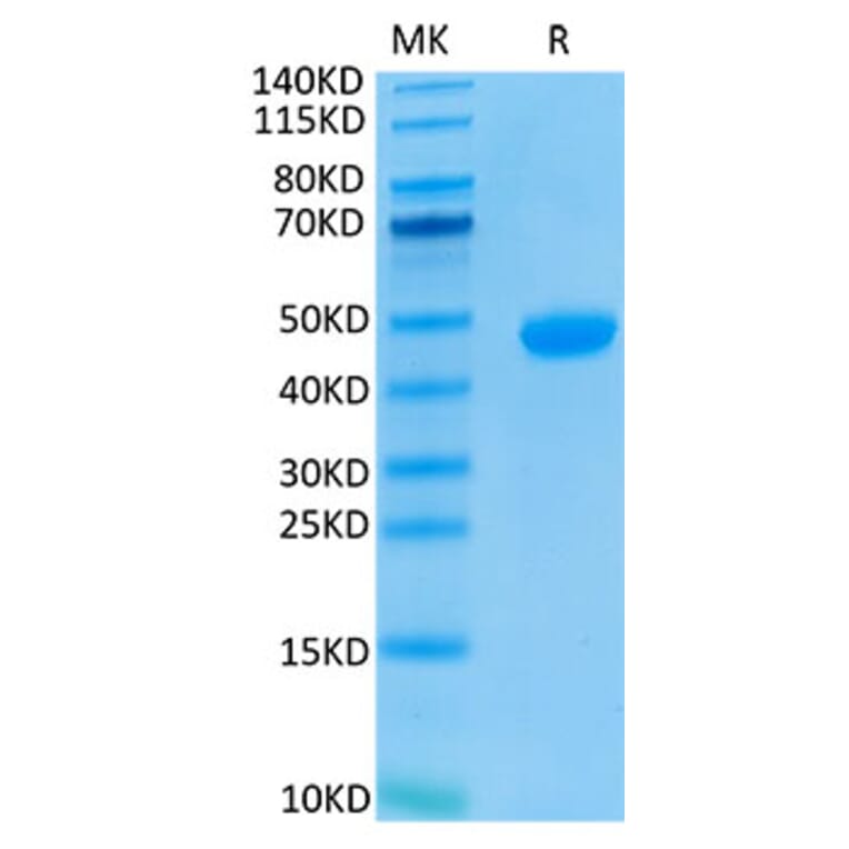 Tris-Bis PAGE - Recombinant Human PVRL4 Protein (Biotin) (C-terminal His and Avi Tag) (A331205) - Antibodies.com