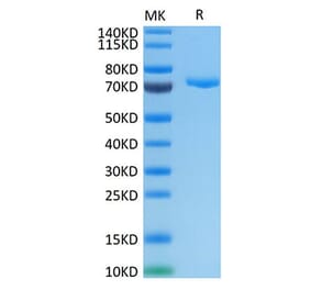 Tris-Bis PAGE - Recombinant Human PVRL4 Protein (C-terminal Human Fc Tag) (A331206) - Antibodies.com