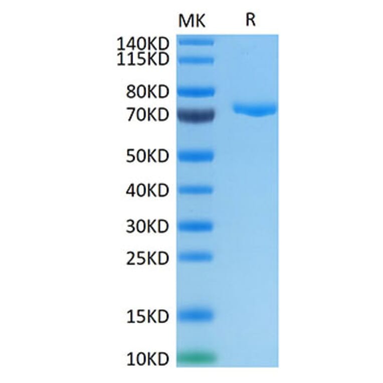 Tris-Bis PAGE - Recombinant Human PVRL4 Protein (C-terminal Human Fc Tag) (A331206) - Antibodies.com