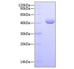 SDS-PAGE - Recombinant Human PVRL4 Protein (C-terminal His Tag) (A331207) - Antibodies.com