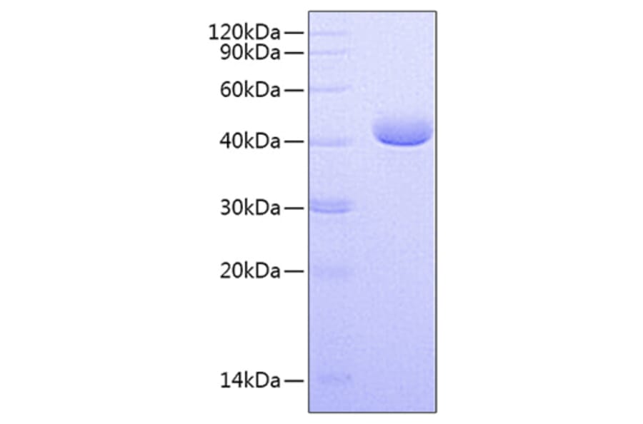 SDS-PAGE - Recombinant Human PVRL4 Protein (C-terminal His Tag) (A331207) - Antibodies.com