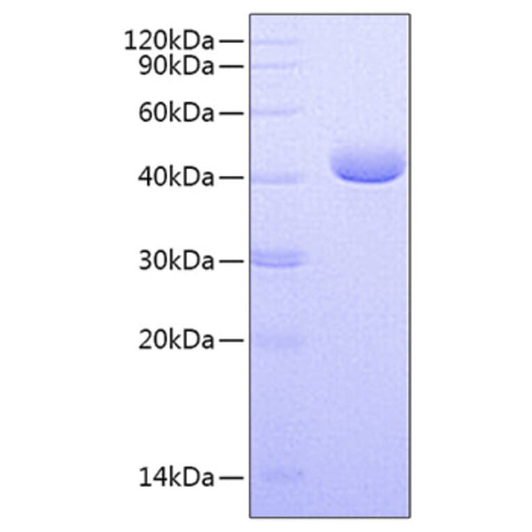 SDS-PAGE - Recombinant Human PVRL4 Protein (C-terminal His Tag) (A331207) - Antibodies.com