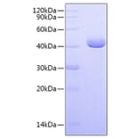 SDS-PAGE - Recombinant Human PVRL4 Protein (C-terminal His Tag) (A331207) - Antibodies.com
