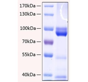 SDS-PAGE - Recombinant Human RAGE Protein (C-terminal Human Fc and His Tag) (A331208) - Antibodies.com