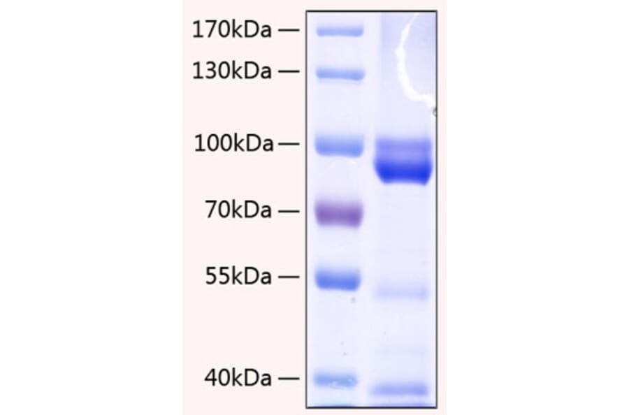 SDS-PAGE - Recombinant Human RAGE Protein (C-terminal Human Fc and His Tag) (A331208) - Antibodies.com