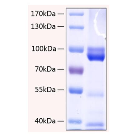 SDS-PAGE - Recombinant Human RAGE Protein (C-terminal Human Fc and His Tag) (A331208) - Antibodies.com