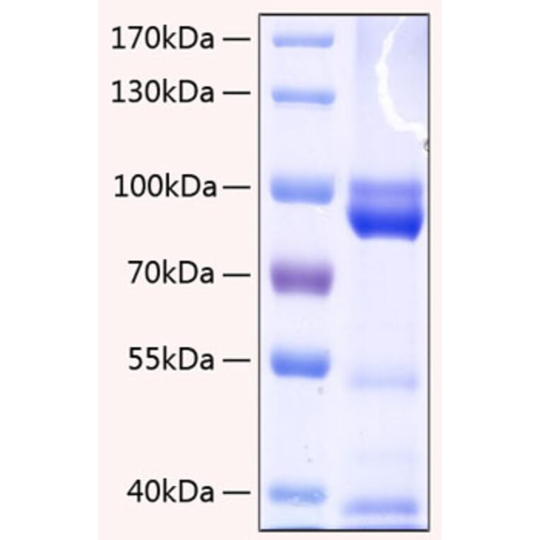 SDS-PAGE - Recombinant Human RAGE Protein (C-terminal Human Fc and His Tag) (A331208) - Antibodies.com