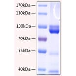SDS-PAGE - Recombinant Human RAGE Protein (C-terminal Human Fc and His Tag) (A331208) - Antibodies.com