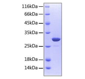 SDS-PAGE - Recombinant Human RANK Protein (C-terminal His Tag) (A331209) - Antibodies.com