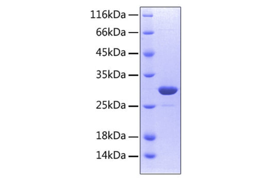 SDS-PAGE - Recombinant Human RANK Protein (C-terminal His Tag) (A331209) - Antibodies.com