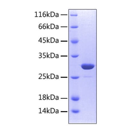 SDS-PAGE - Recombinant Human RANK Protein (C-terminal His Tag) (A331209) - Antibodies.com