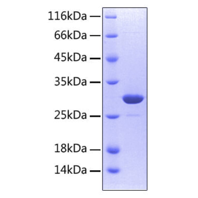 SDS-PAGE - Recombinant Human RANK Protein (C-terminal His Tag) (A331209) - Antibodies.com