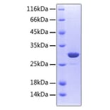 SDS-PAGE - Recombinant Human RANK Protein (C-terminal His Tag) (A331209) - Antibodies.com