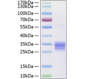 SDS-PAGE - Recombinant Human RANKL Protein (N-terminal His Tag) (A331210) - Antibodies.com