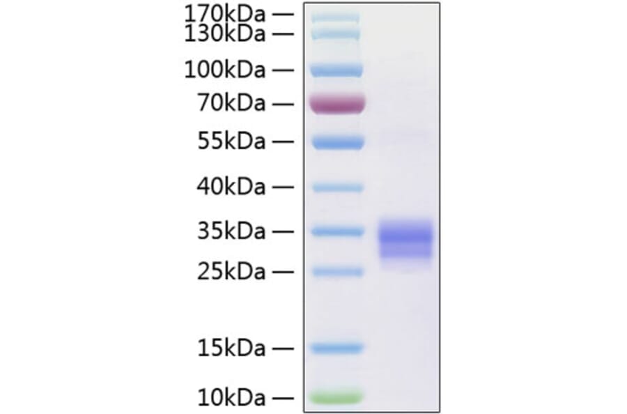 SDS-PAGE - Recombinant Human RANKL Protein (N-terminal His Tag) (A331210) - Antibodies.com