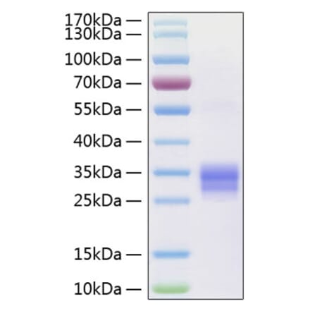 SDS-PAGE - Recombinant Human RANKL Protein (N-terminal His Tag) (A331210) - Antibodies.com