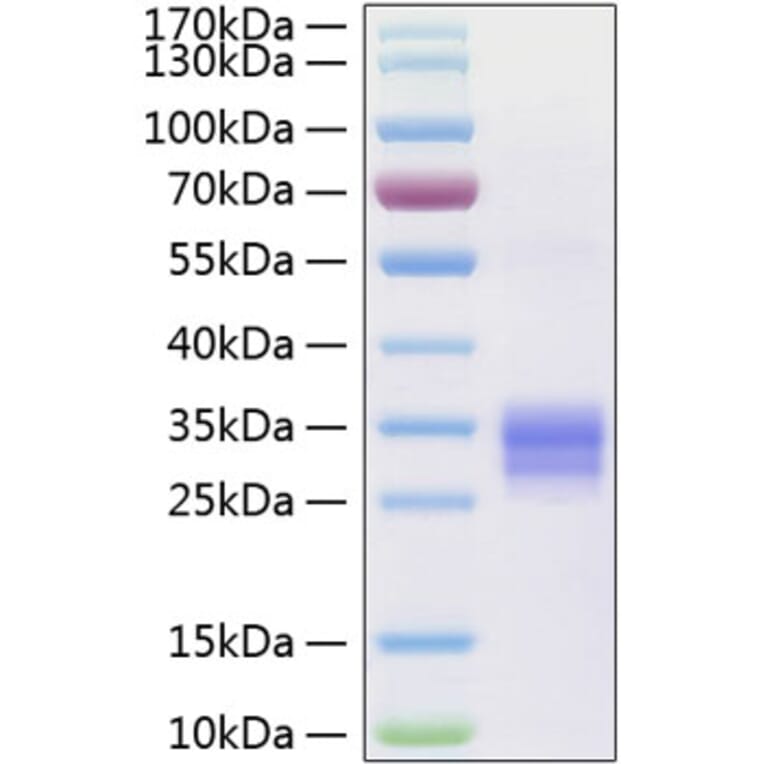 SDS-PAGE - Recombinant Human RANKL Protein (N-terminal His Tag) (A331210) - Antibodies.com
