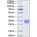 SDS-PAGE - Recombinant Human RANKL Protein (N-terminal His Tag) (A331210) - Antibodies.com