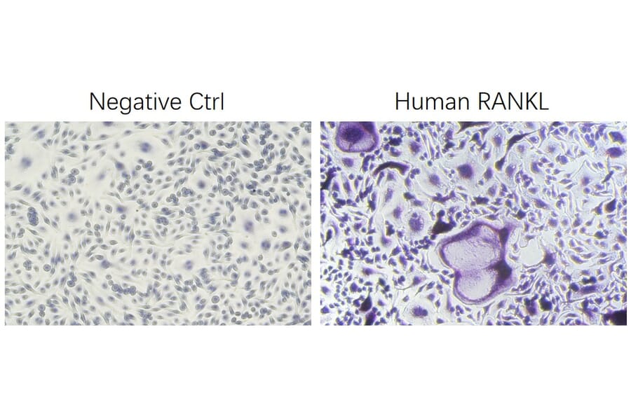 ICC - Recombinant Human RANKL Protein (N-terminal His Tag) (A331210) - Antibodies.com